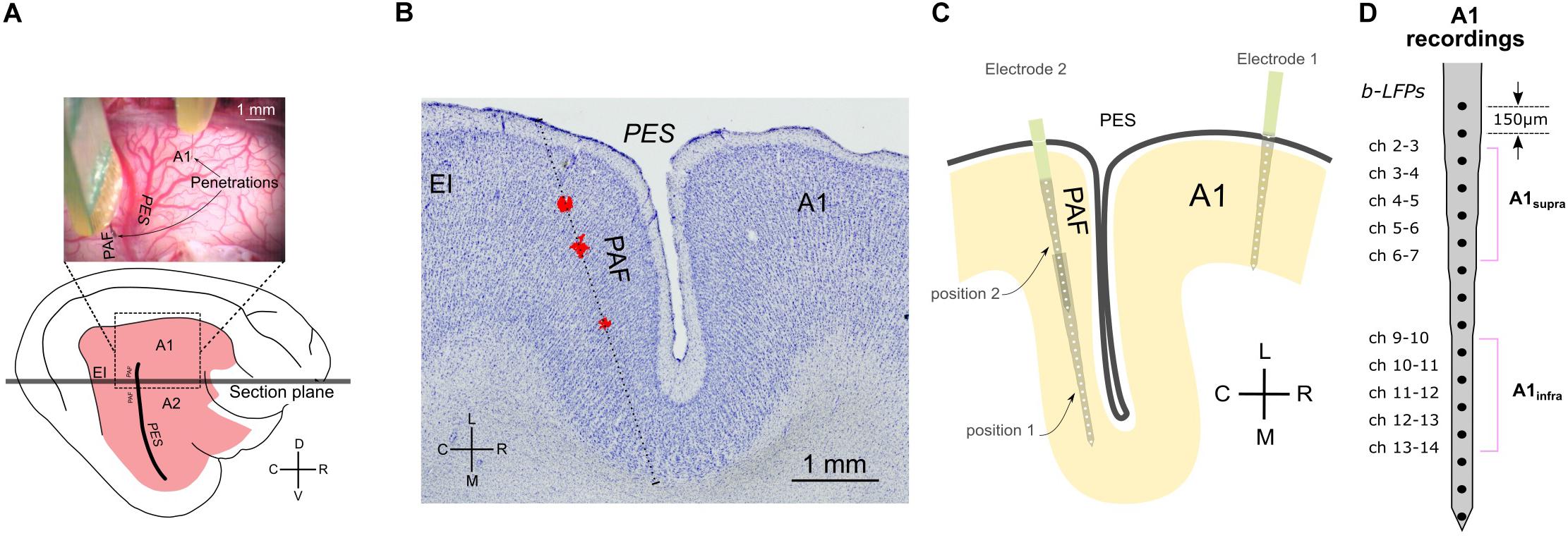 Deafness Weakens Interareal Couplings in the Auditory Cortex